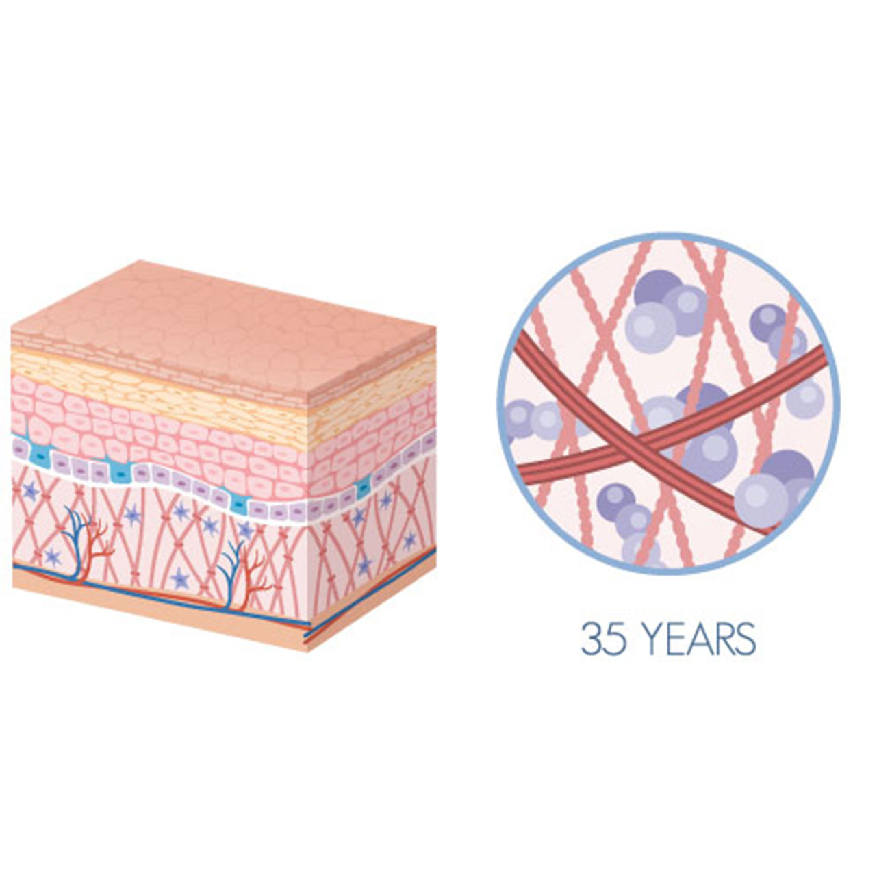 Diagramme de l’apparence de la peau et du niveau de collagène - après 30 ans