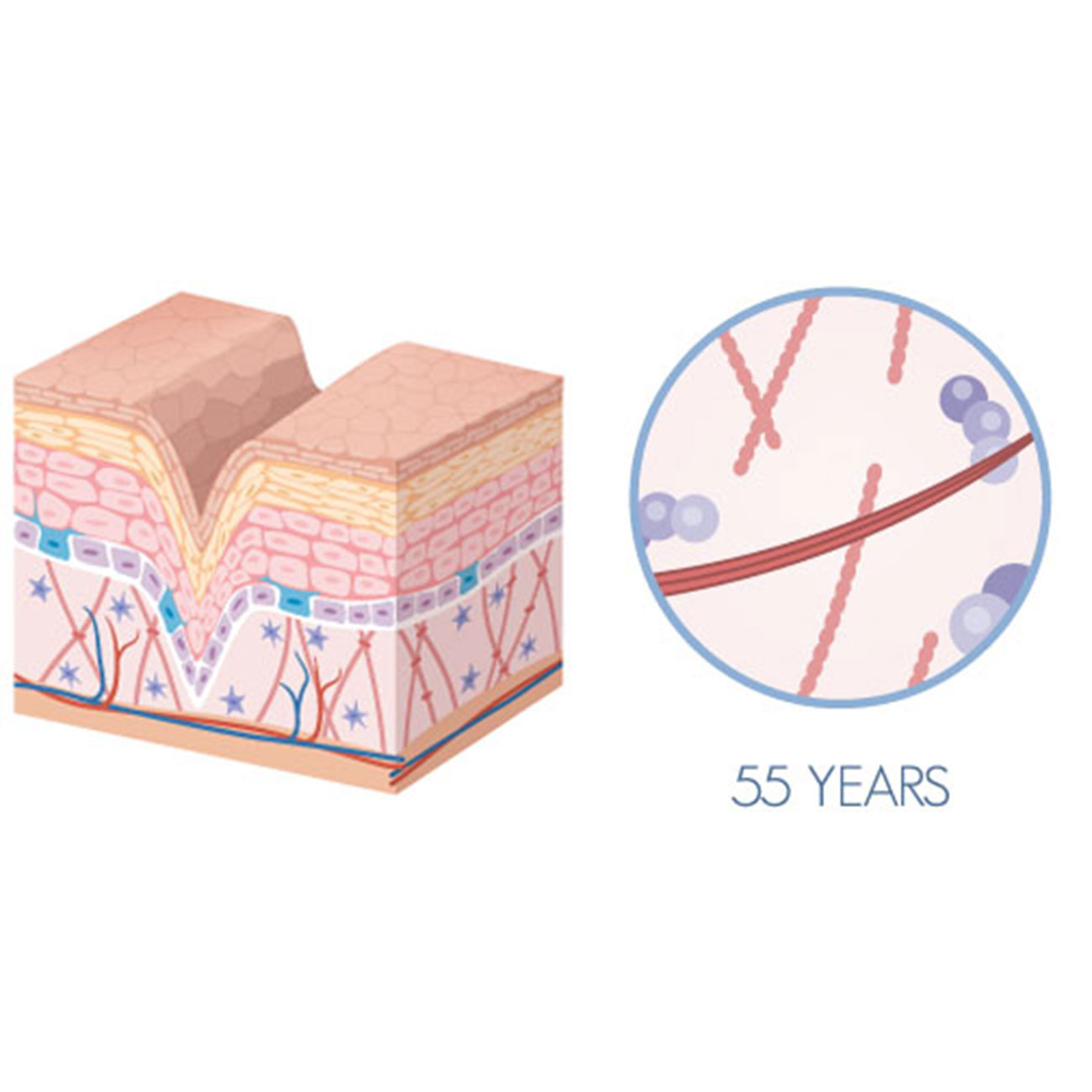 Diagramme de l’apparence de la peau et du niveau de collagène - après 50 ans